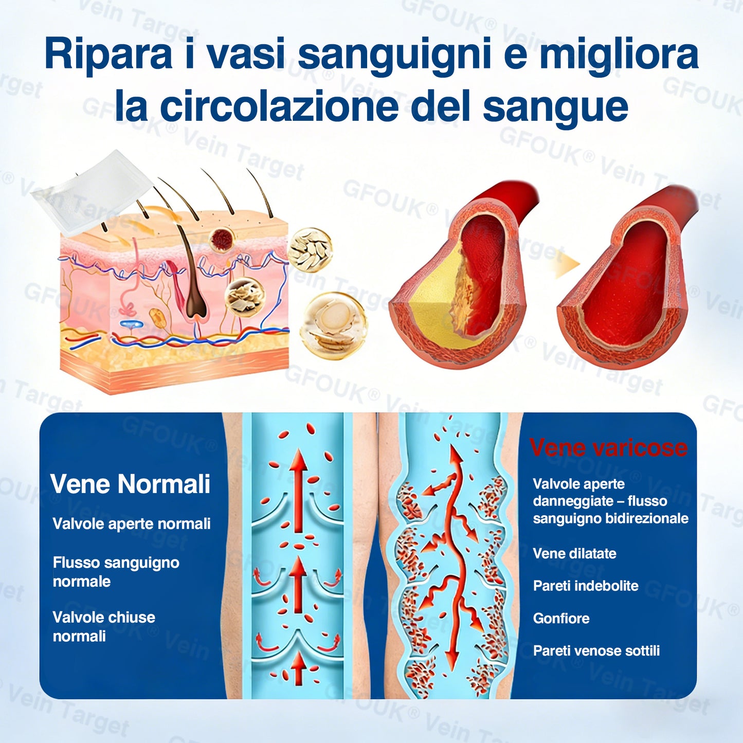 🇮🇹👨‍⚕️✅✅GFOUK® VeinTarget Cerotto a Microaghi⚡Sollievo Immediato, Risultati a Lungo Termine