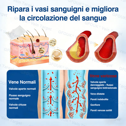 🇮🇹👨‍⚕️✅✅GFOUK® VeinTarget Cerotto a Microaghi⚡Sollievo Immediato, Risultati a Lungo Termine