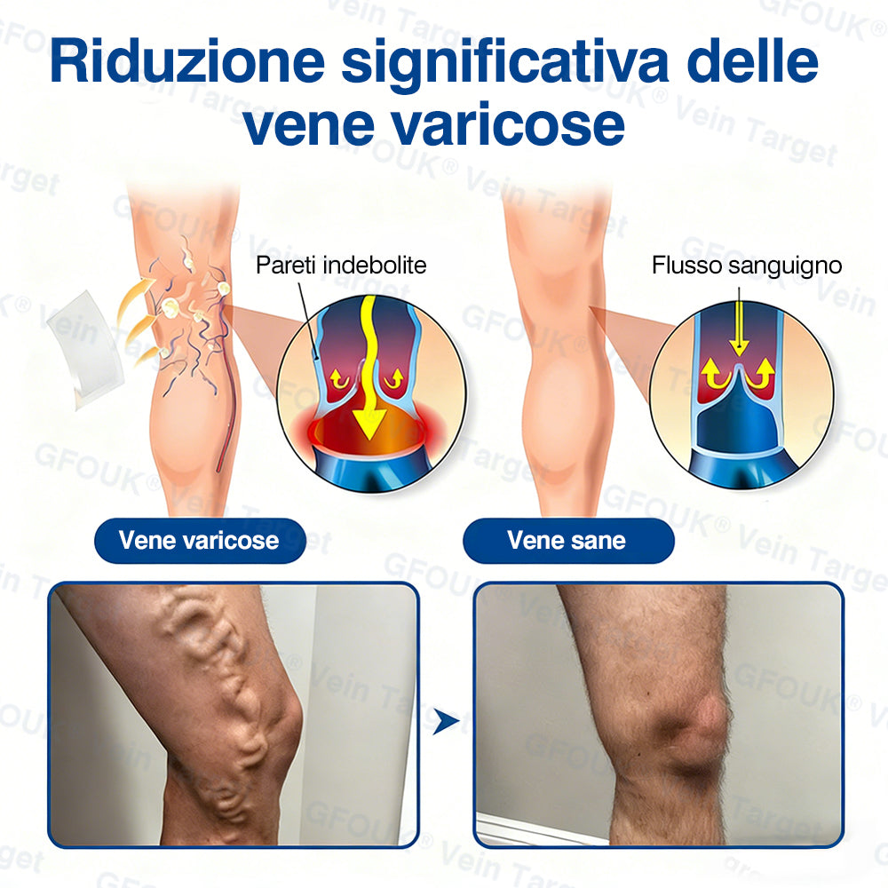 🇮🇹👨‍⚕️✅✅GFOUK® VeinTarget Cerotto a Microaghi⚡Sollievo Immediato, Risultati a Lungo Termine