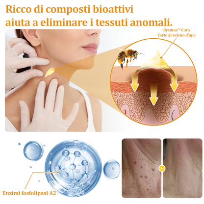 🌟flysmus™ Cura Forte al veleno d'ape: trattamento efficace per verruche, escrescenze cutanee, infezioni e cicatrici, favorisce il rinnovo e la levigatura della pelle irregolare 👨‍⚕️