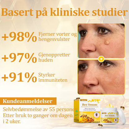 🌟flysmus™ Cura Forte al veleno d'ape: trattamento efficace per verruche, escrescenze cutanee, infezioni e cicatrici, favorisce il rinnovo e la levigatura della pelle irregolare 👨‍⚕️