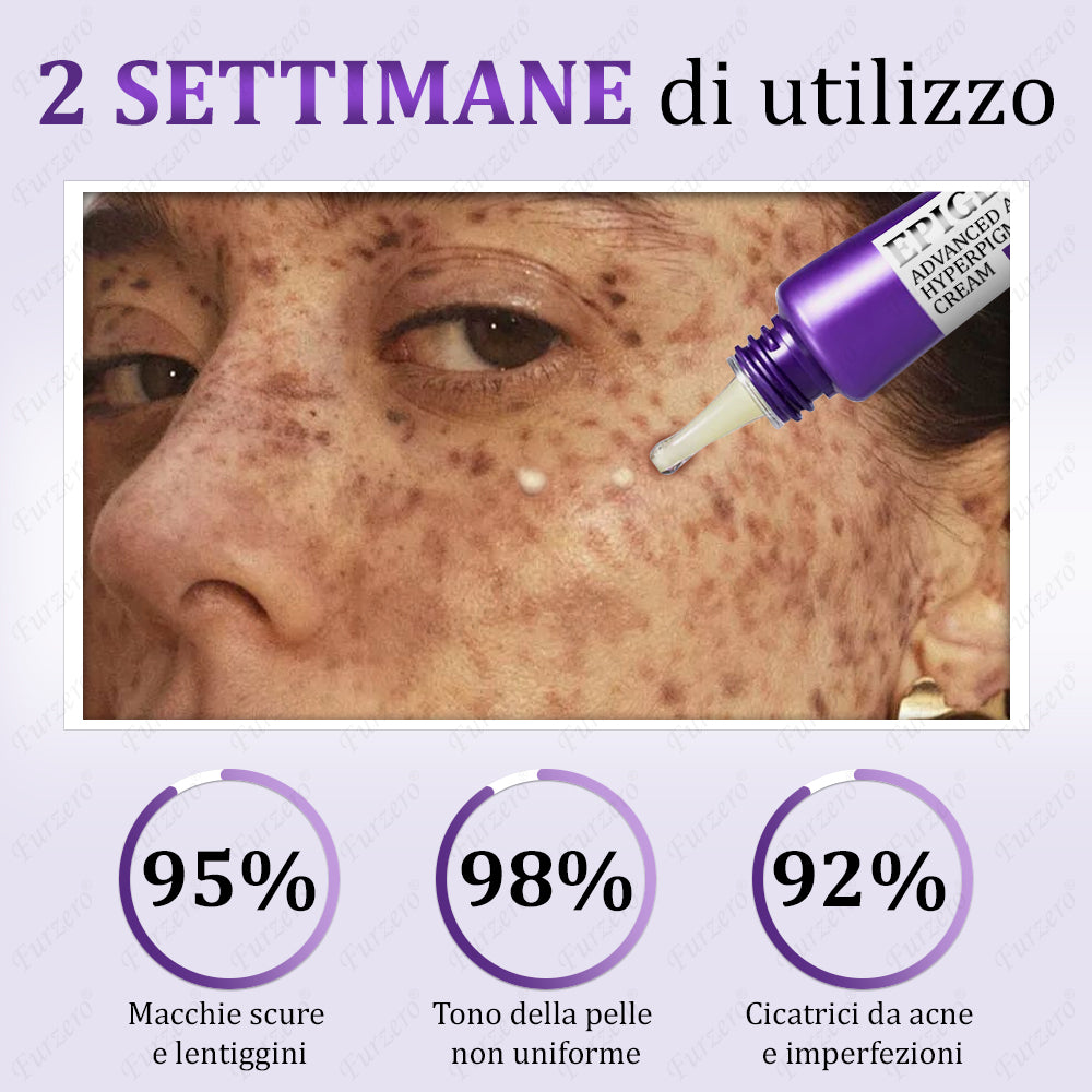 🌹𝐒𝐒𝐍 𝐀𝐩𝐩𝐫𝐨𝐯𝐚𝐭𝐨 | 𝐅𝐮𝐫𝐳𝐞𝐫𝐨® 𝐄𝐏𝐈𝐆𝐋𝐎𝐖 𝐌𝐞𝐥𝐚𝐧𝐄𝐗 𝐂𝐫𝐞𝐦𝐚 𝐀𝐯𝐚𝐧𝐳𝐚𝐭𝐚 𝐀𝐧𝐭𝐢-𝐈𝐩𝐞𝐫𝐩𝐢𝐠𝐦𝐞𝐧𝐭𝐚𝐳𝐢𝐨𝐧𝐞