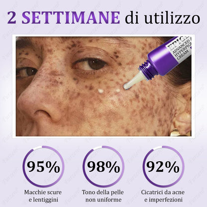 🌹𝐒𝐒𝐍 𝐀𝐩𝐩𝐫𝐨𝐯𝐚𝐭𝐨 | 𝐅𝐮𝐫𝐳𝐞𝐫𝐨® 𝐄𝐏𝐈𝐆𝐋𝐎𝐖 𝐌𝐞𝐥𝐚𝐧𝐄𝐗 𝐂𝐫𝐞𝐦𝐚 𝐀𝐯𝐚𝐧𝐳𝐚𝐭𝐚 𝐀𝐧𝐭𝐢-𝐈𝐩𝐞𝐫𝐩𝐢𝐠𝐦𝐞𝐧𝐭𝐚𝐳𝐢𝐨𝐧𝐞