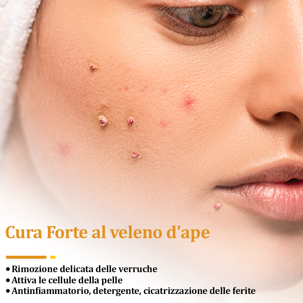 🌟flysmus™ Cura Forte al veleno d'ape: trattamento efficace per verruche, escrescenze cutanee, infezioni e cicatrici, favorisce il rinnovo e la levigatura della pelle irregolare 👨‍⚕️