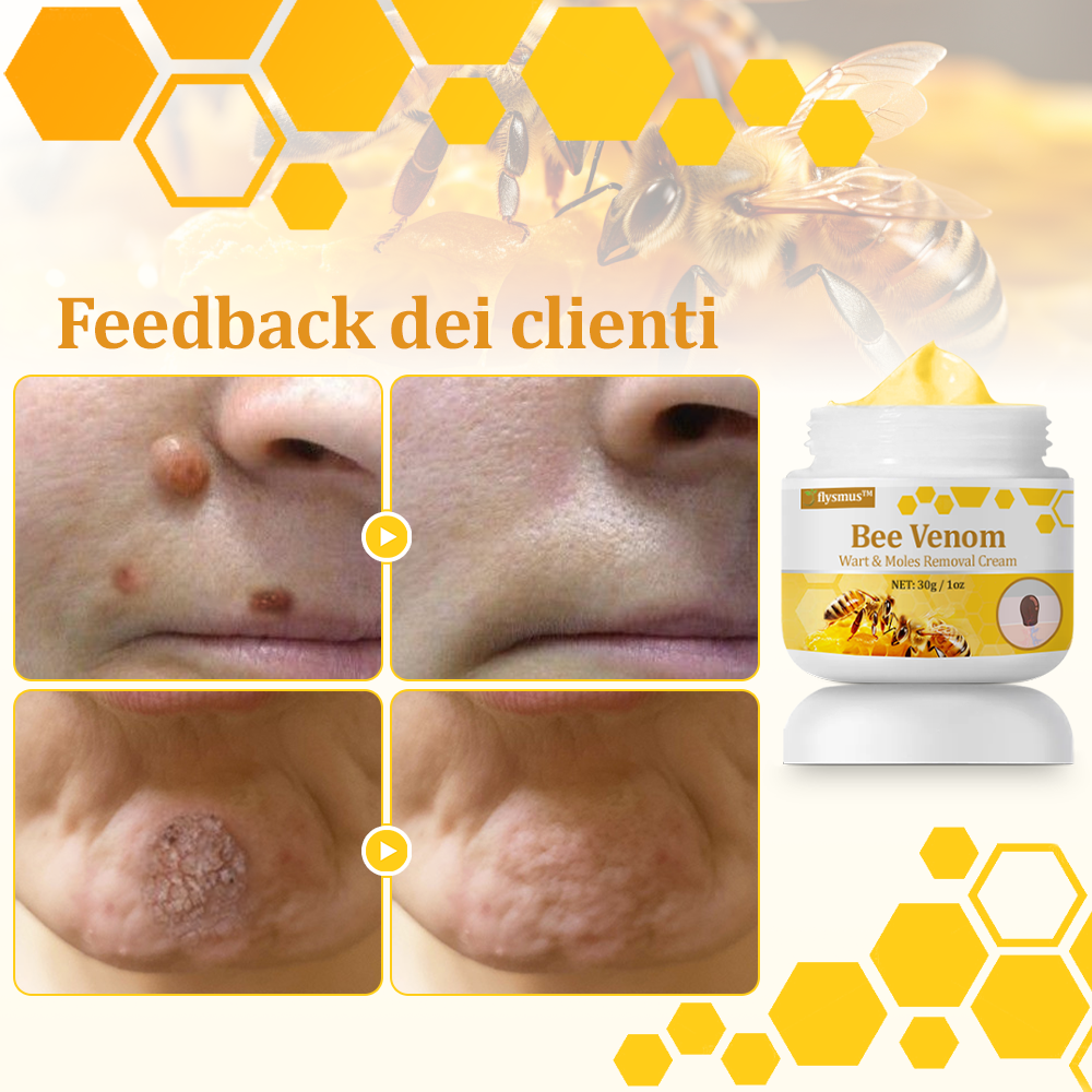 🌟flysmus™ Cura Forte al veleno d'ape: trattamento efficace per verruche, escrescenze cutanee, infezioni e cicatrici, favorisce il rinnovo e la levigatura della pelle irregolare 👨‍⚕️
