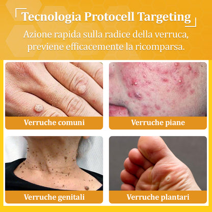🍀flysmus® Crema al Veleno d’Ape – Testata da dermatologi. Efficace contro verruche, noduli, lesioni, infezioni e cicatrici.