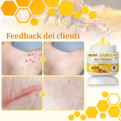 🌟flysmus™ Cura Forte al veleno d'ape: trattamento efficace per verruche, escrescenze cutanee, infezioni e cicatrici, favorisce il rinnovo e la levigatura della pelle irregolare 👨‍⚕️