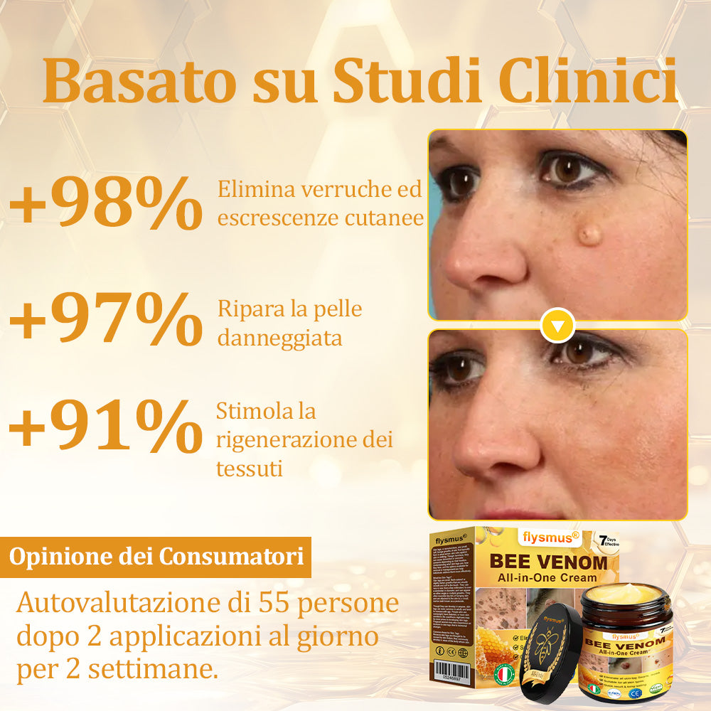 🍀flysmus® Crema al Veleno d’Ape – Testata da dermatologi. Efficace contro verruche, noduli, lesioni, infezioni e cicatrici.