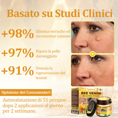 🍀flysmus® Crema al Veleno d’Ape – Testata da dermatologi. Efficace contro verruche, noduli, lesioni, infezioni e cicatrici.