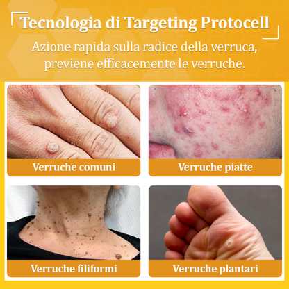 🌟flysmus™ Cura Forte al veleno d'ape: trattamento efficace per verruche, escrescenze cutanee, infezioni e cicatrici, favorisce il rinnovo e la levigatura della pelle irregolare 👨‍⚕️