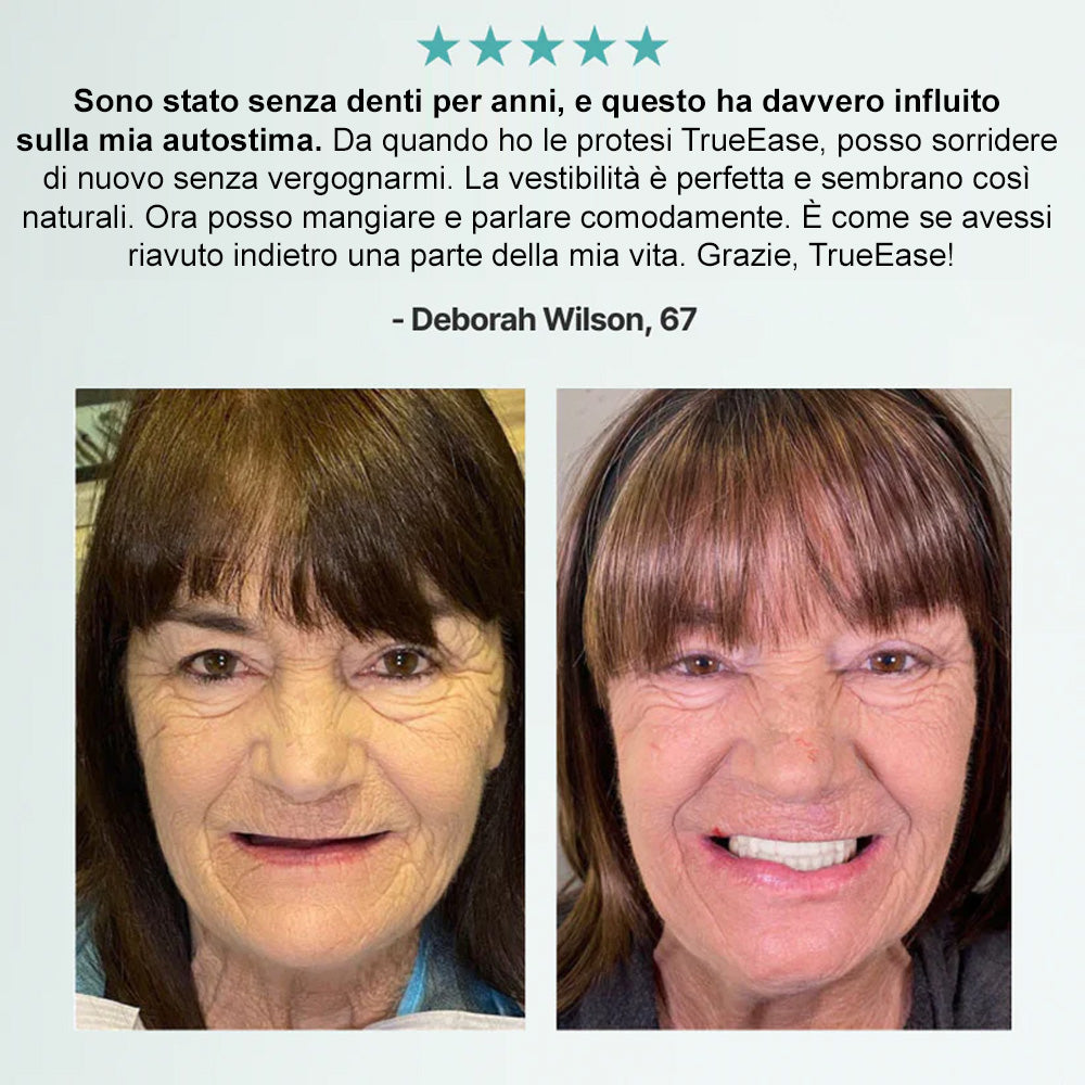 🦷𝗕𝗶𝗸𝗲𝗻𝗱𝗮® 🦷 𝗦𝗲𝘁 𝗔𝘃𝗮𝗻𝘇𝗮𝘁𝗼 𝗱𝗶 𝗣𝗿𝗼𝘁𝗲𝘀𝗶 𝗣𝗲𝗿𝘀𝗼𝗻𝗮𝗹𝗶𝘇𝘇𝗮𝘁𝗲 𝗖𝗼𝗺𝗽𝗹𝗲𝘁𝗲 (✅ Protesi con comfort clinicamente comprovato — Fidate da oltre 8.000 utenti italiani per un comfort tutto il giorno.)