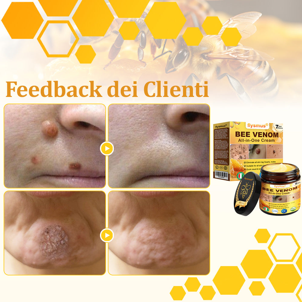 🍀flysmus® Crema al Veleno d’Ape – Testata da dermatologi. Efficace contro verruche, noduli, lesioni, infezioni e cicatrici.
