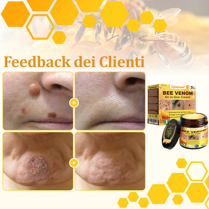 🍀flysmus® Crema al Veleno d’Ape – Testata da dermatologi. Efficace contro verruche, noduli, lesioni, infezioni e cicatrici.