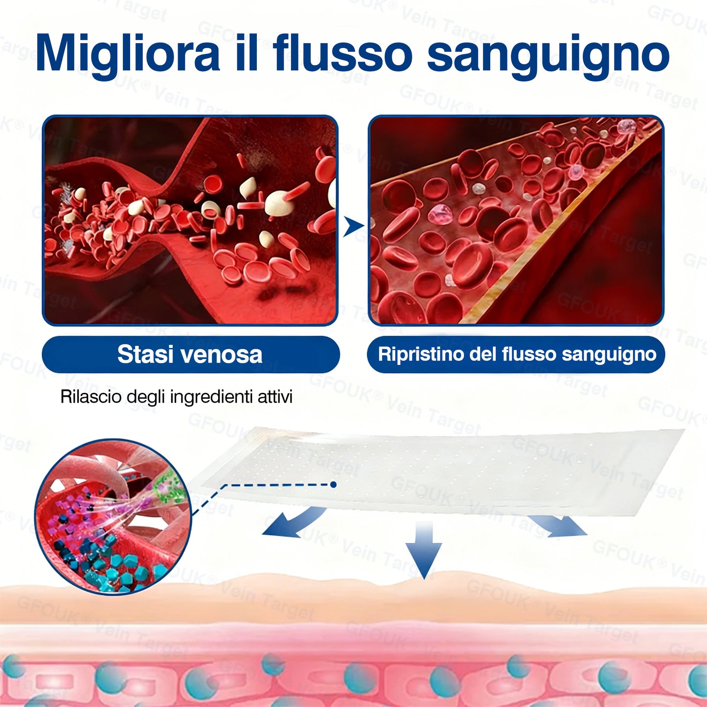 🇮🇹👨‍⚕️✅✅GFOUK® VeinTarget Cerotto a Microaghi⚡Sollievo Immediato, Risultati a Lungo Termine